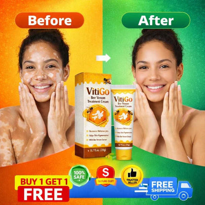 MD Vitigo™ Advanced Vitiligo Restore Cream ✨ | Buy 1 Get 1 Free 🔥
